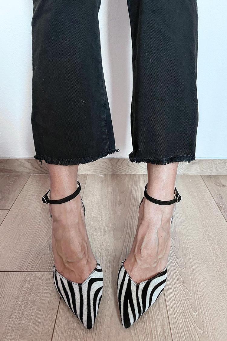 ZEBRA-PRINT PUMPS MIT KNÖCHELRIEMEN - Image 2